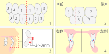 歯並び・咬み合わせについて