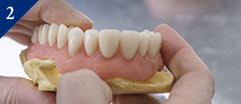 メインテナンスでより使いやすい入れ歯に調整します