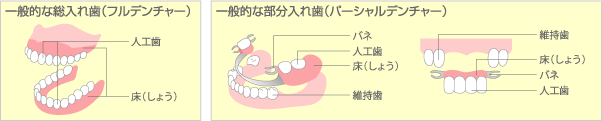 入れ歯の形状について