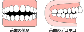 トランスクリアに適した例