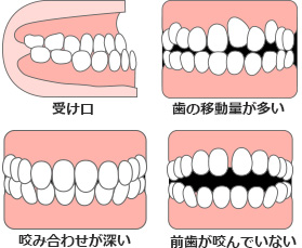 トランスクリアに適さない例