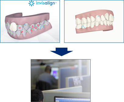 口腔内スキャナによって出来た画像をもとに、海外のオペレーターに矯正の設計の指示をします。