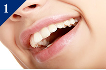 特殊歯周病治療で中等度～重度の歯周病も改善