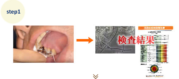 口腔内基本検査＋細菌検査（BML社製）