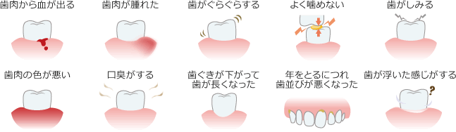 歯周病かな？と思ったら歯周病チェック