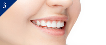 豊富な予防メニューで徹底的なむし歯予防