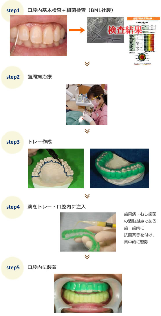 3DSの流れ