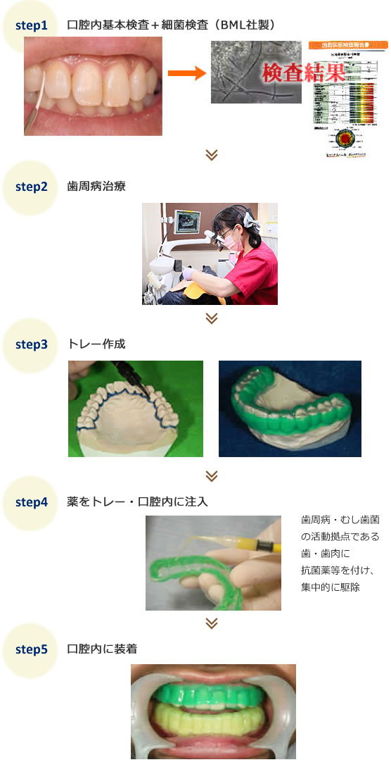 3DSの流れ